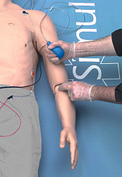 Adjustable Pulse Points